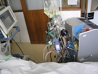 Ростех зарегистрировал уникальный аппарат для экстренного восстановления кровообращения