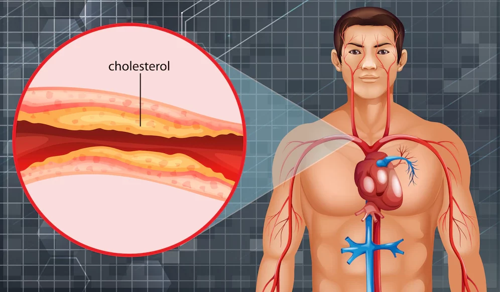 Невролог Борисов: Для понижения холестерина следует скорректировать образ жизни