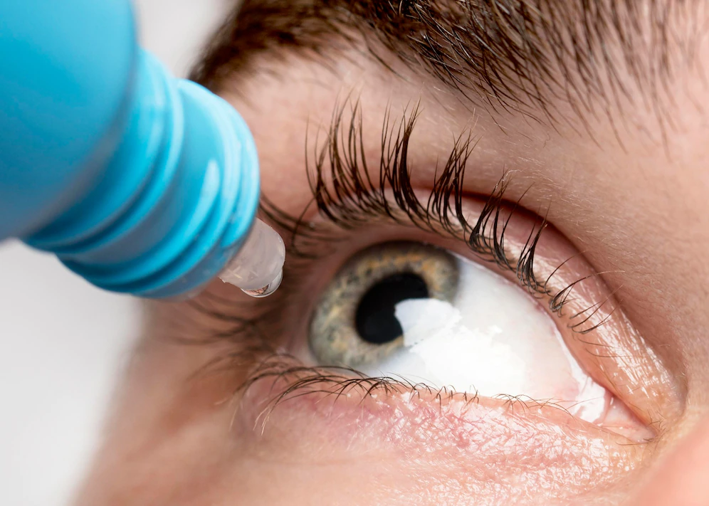 Офтальмолог Боша: Частое использование глазных капель чревато отеком роговицы