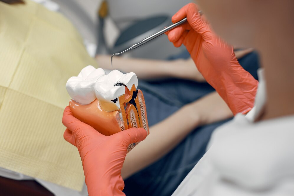 Стоматолог Трифонова: Невылеченный кариес грозит обширным поражением зуба