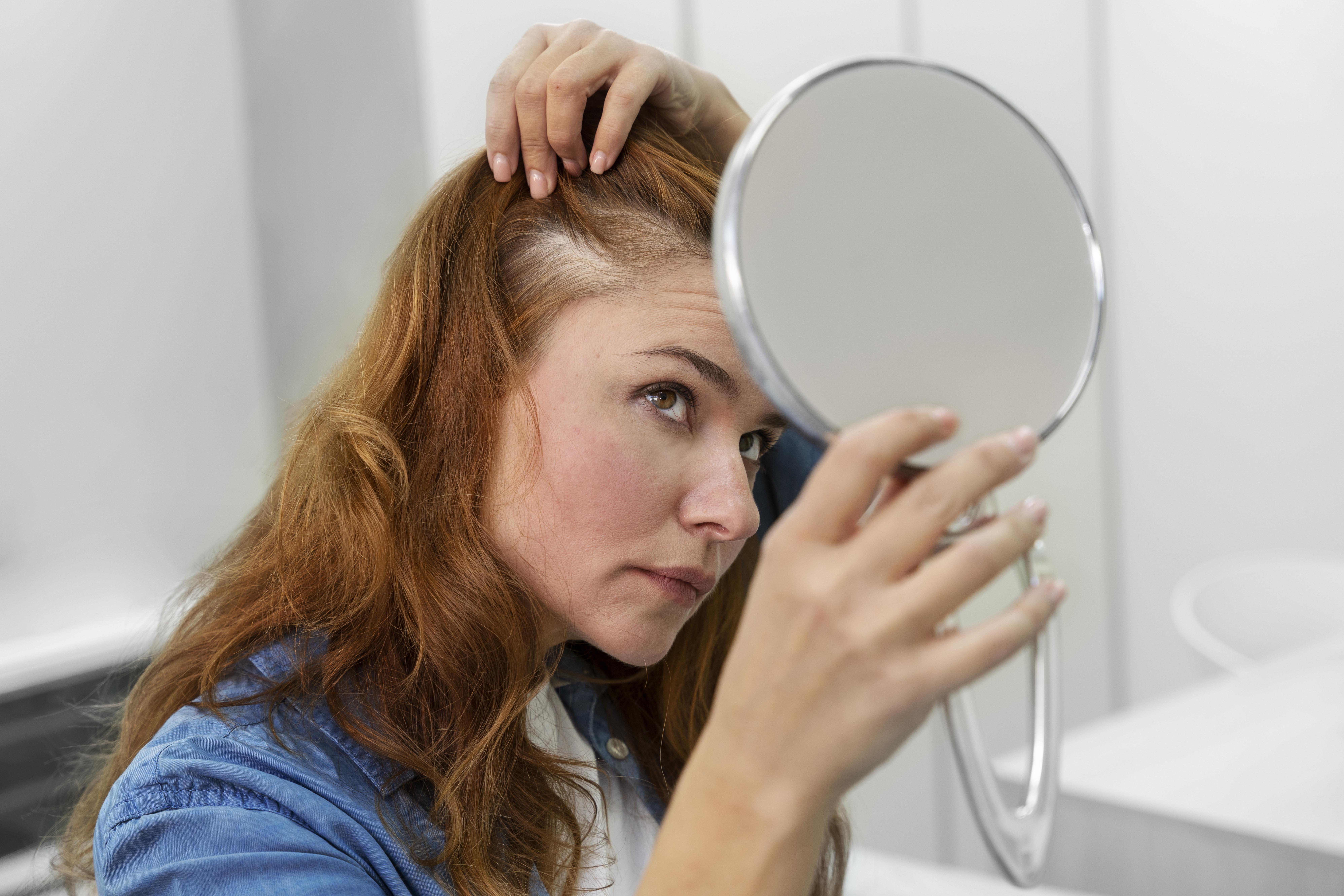 Трихолог Дорош: Основной причиной выпадения волос является наследственность