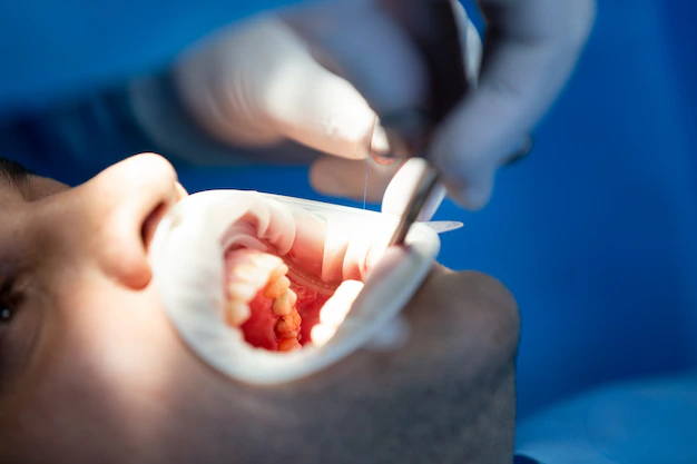 Стоматолог Колупанова: За новогодние праздники можно избавиться от зубного камня