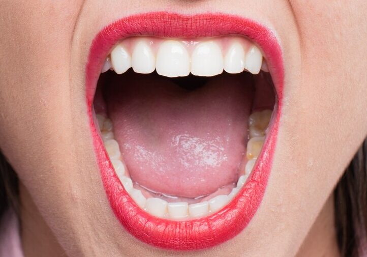 Стоматолог Альбова посоветовала полоскать рот кокосовым маслом