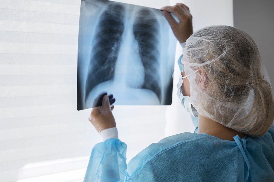 Болезни органов дыхания: Абсцедирующая пневмония