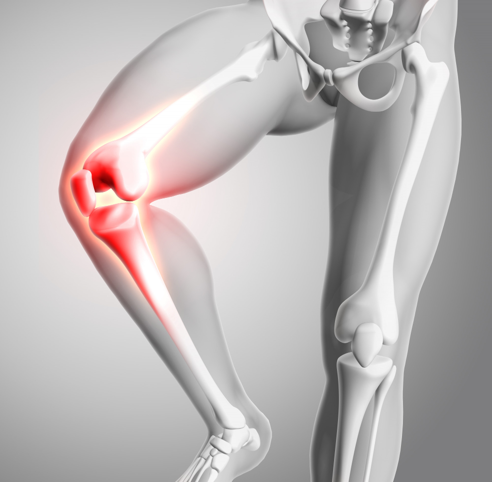 TAMU: В США создали щадящую альтернативу полной замене коленного сустава