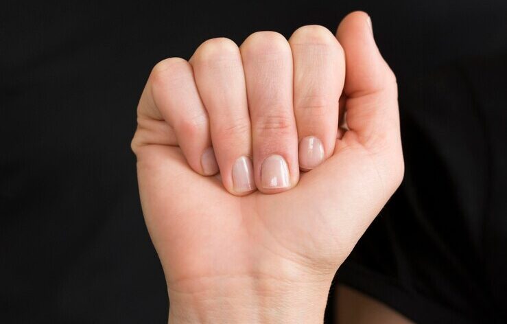Подолог Рушанцева: По состоянию ногтевой пластины можно вывить диабет и болезни печени